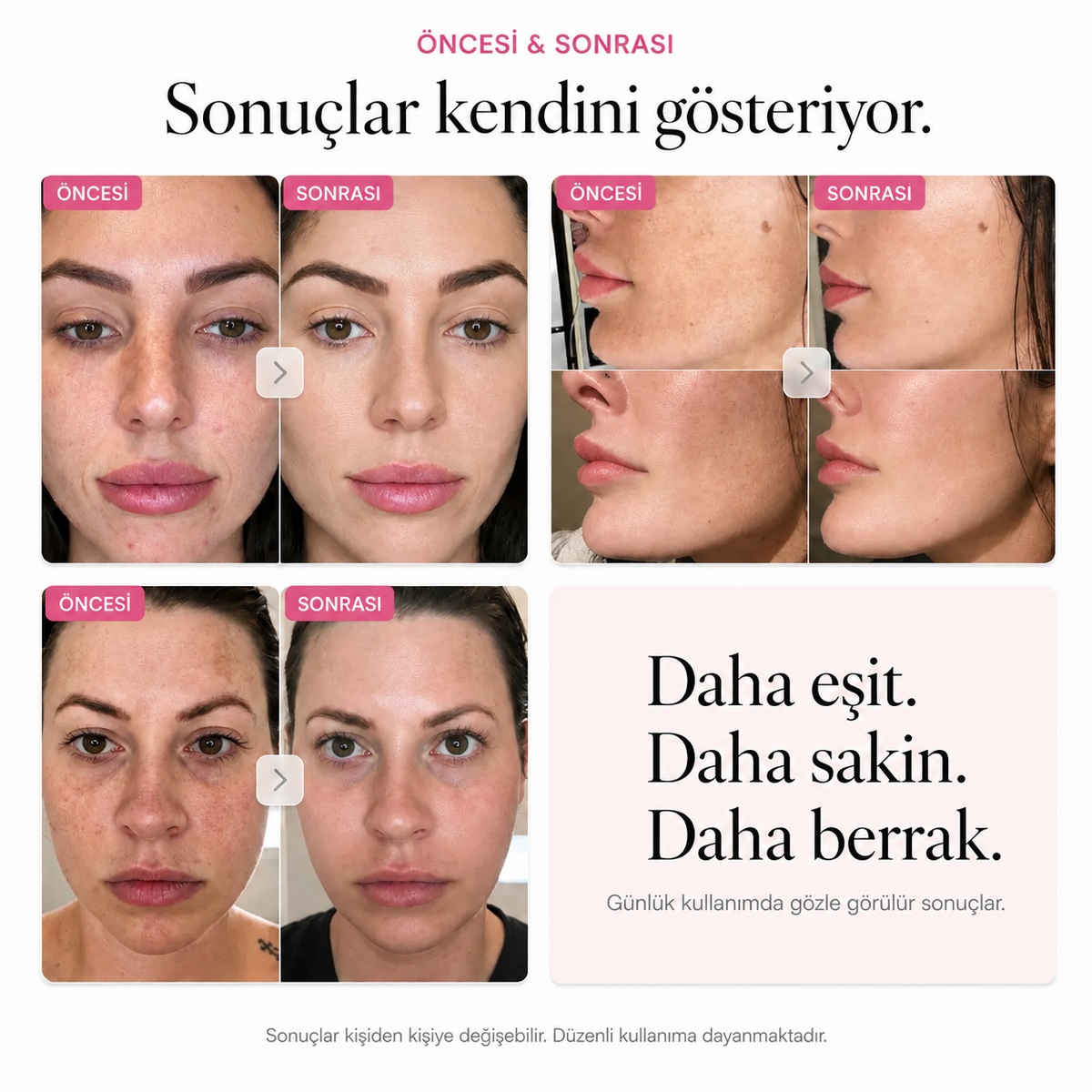 Kore Arbutin Leke Karşıtı Krem
