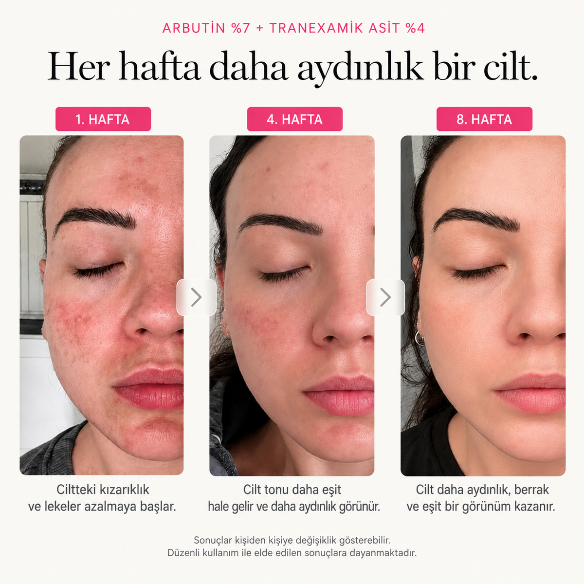 Kore Arbutin Leke Karşıtı Krem