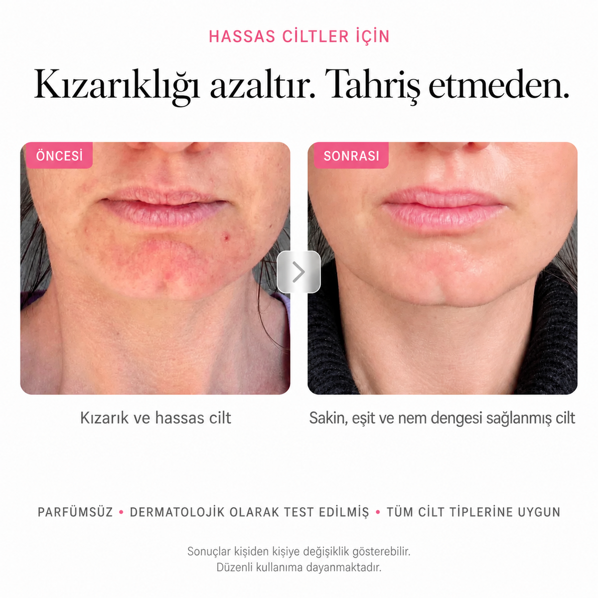 Kore Arbutin Leke Karşıtı Krem
